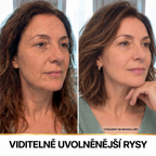 Miol Skin® – Sérum s hedvábnými peptidy a kolagenem