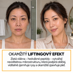 Miol Skin® – Sérum s hedvábnými peptidy a kolagenem