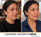 Miol Skin® – Sérum s hedvábnými peptidy a kolagenem